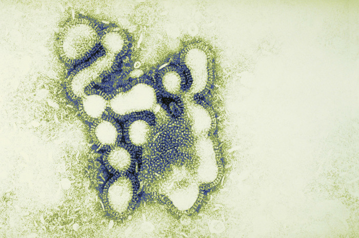 Vaksine mot influensaviruset (avbildet) anbefales spesielt for utsatte grupper.