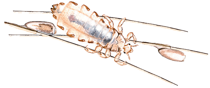 Illustration of a head lice 