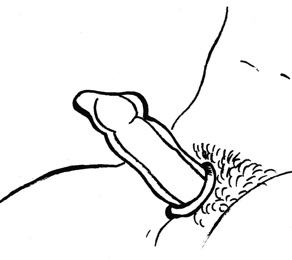 Illustration of a condom 