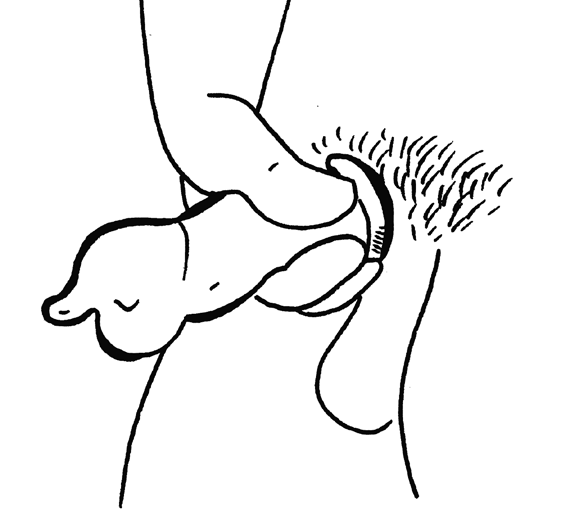 Illustration of a condom