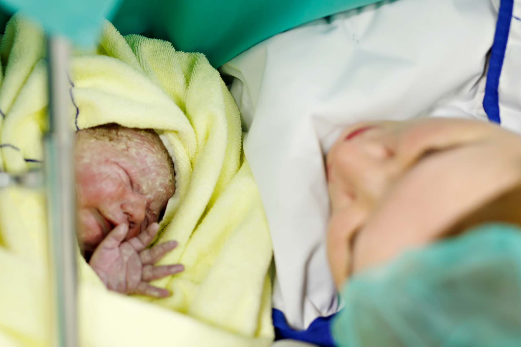 Baby rett etter keisersnitt.