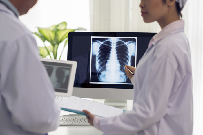Bilde av noen som ser på røntgenbilder av lungekreft