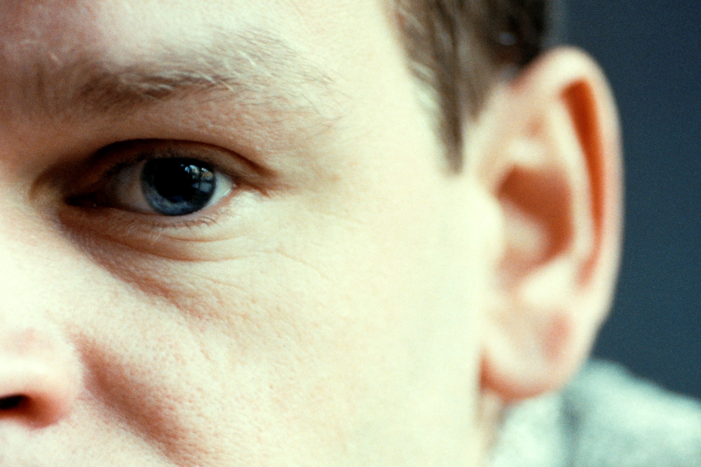 Posttraumatisk stresslidelse (PTSD)