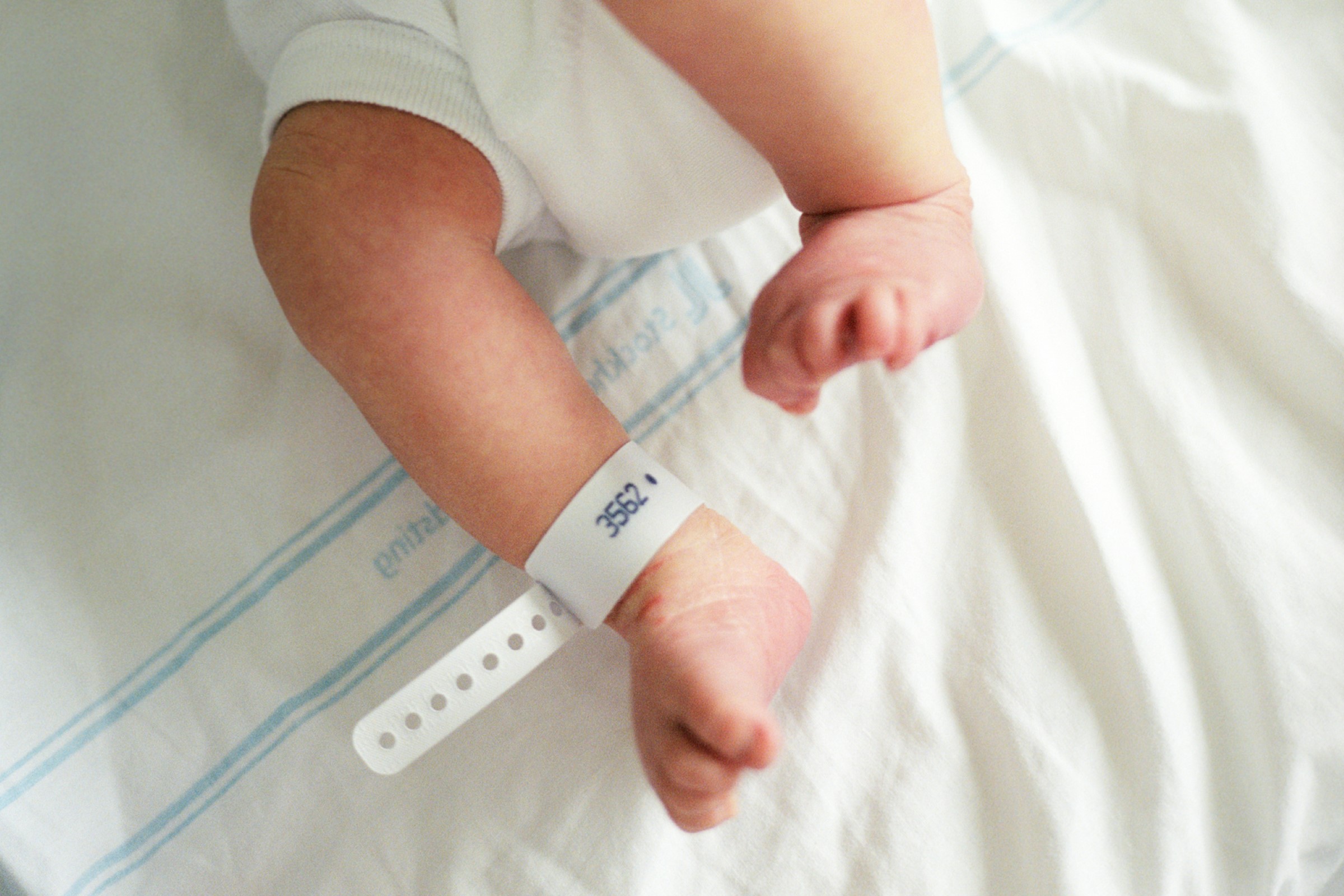 Bilde som illustrerer baby med gruppe B streptokokkinfeksjon