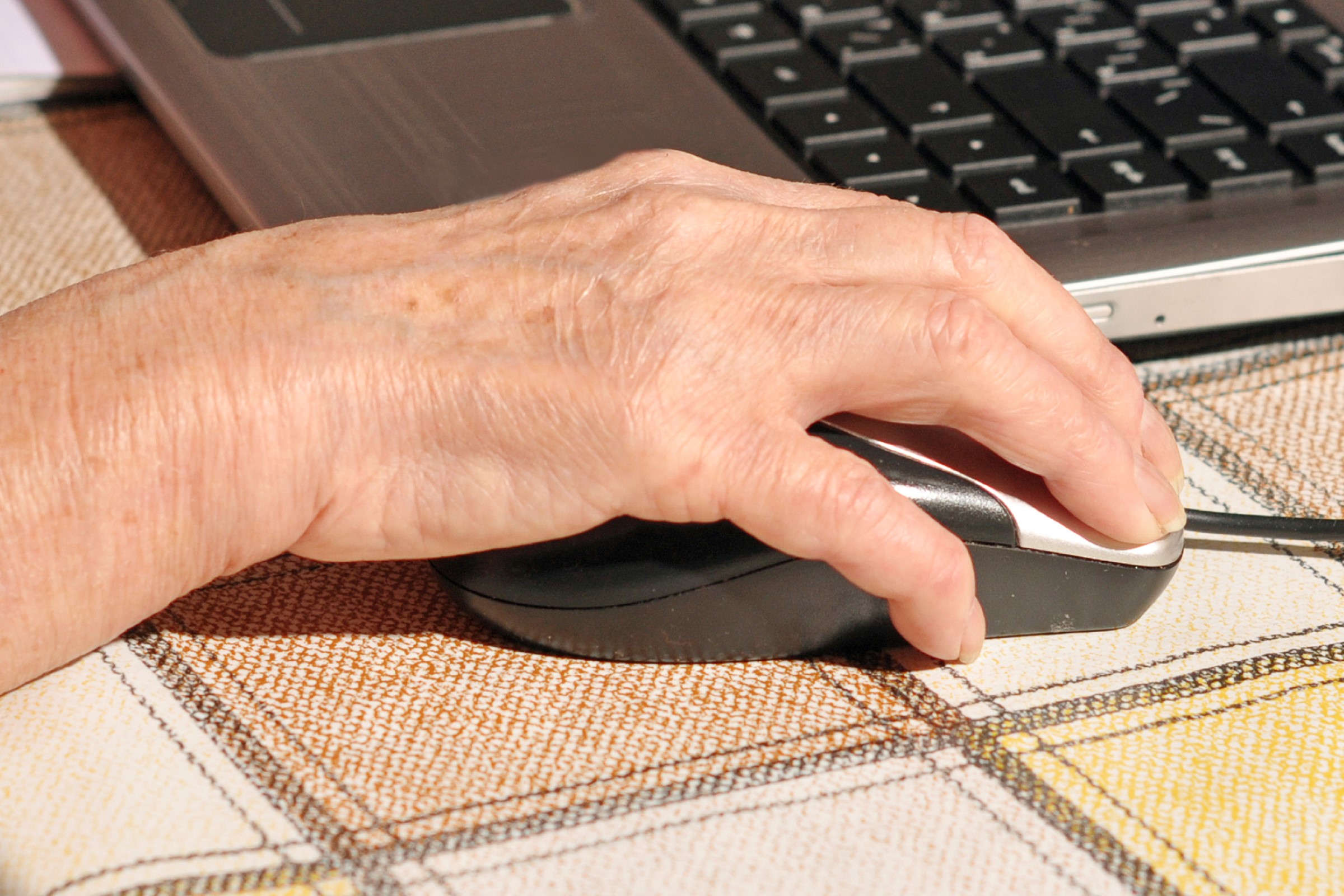 Hendene blir stive ved Parkinsons sykdom.