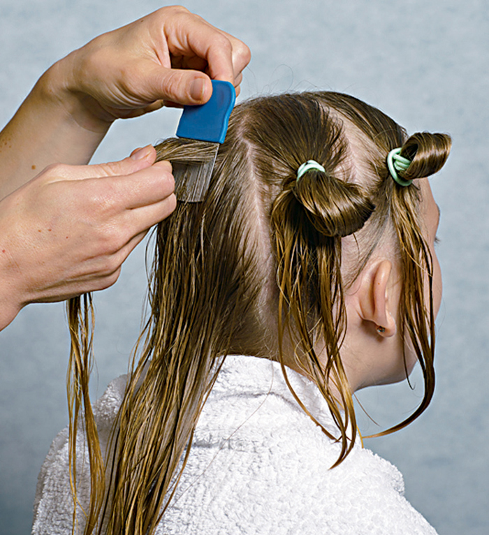 Children are helped by an adult to divide the hair into several ponytails. To find head lice in long hair, it is a good idea to divide the hair into 3–6 ponytails and comb one ponytail at a time. 