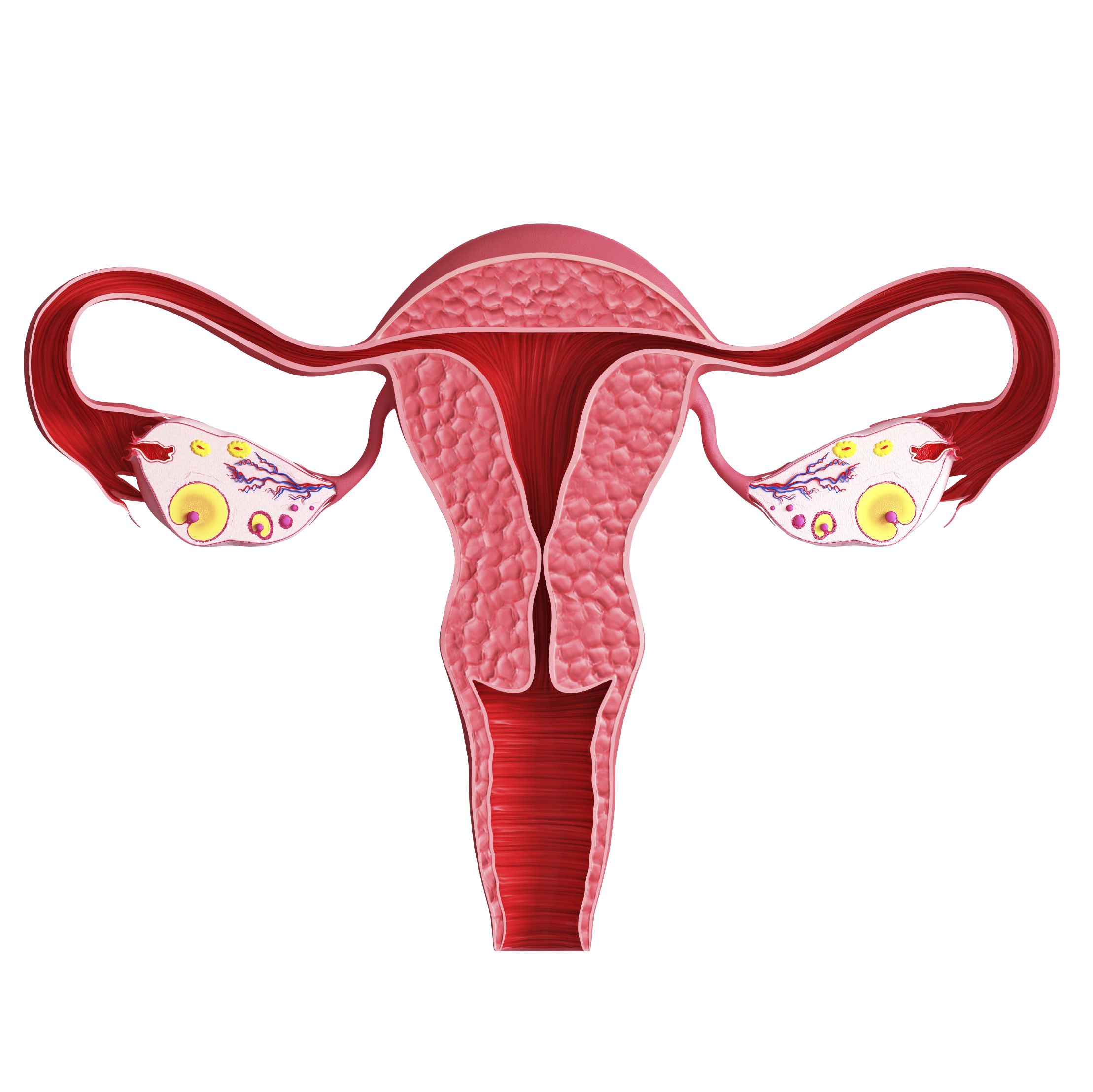 Polycystisk ovariesyndrom betyr at hormonene ikke er i balanse.