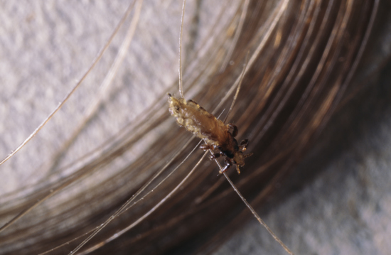 The body of a head lice is grey-white or brown, oval and 2–3 millimeters long.
