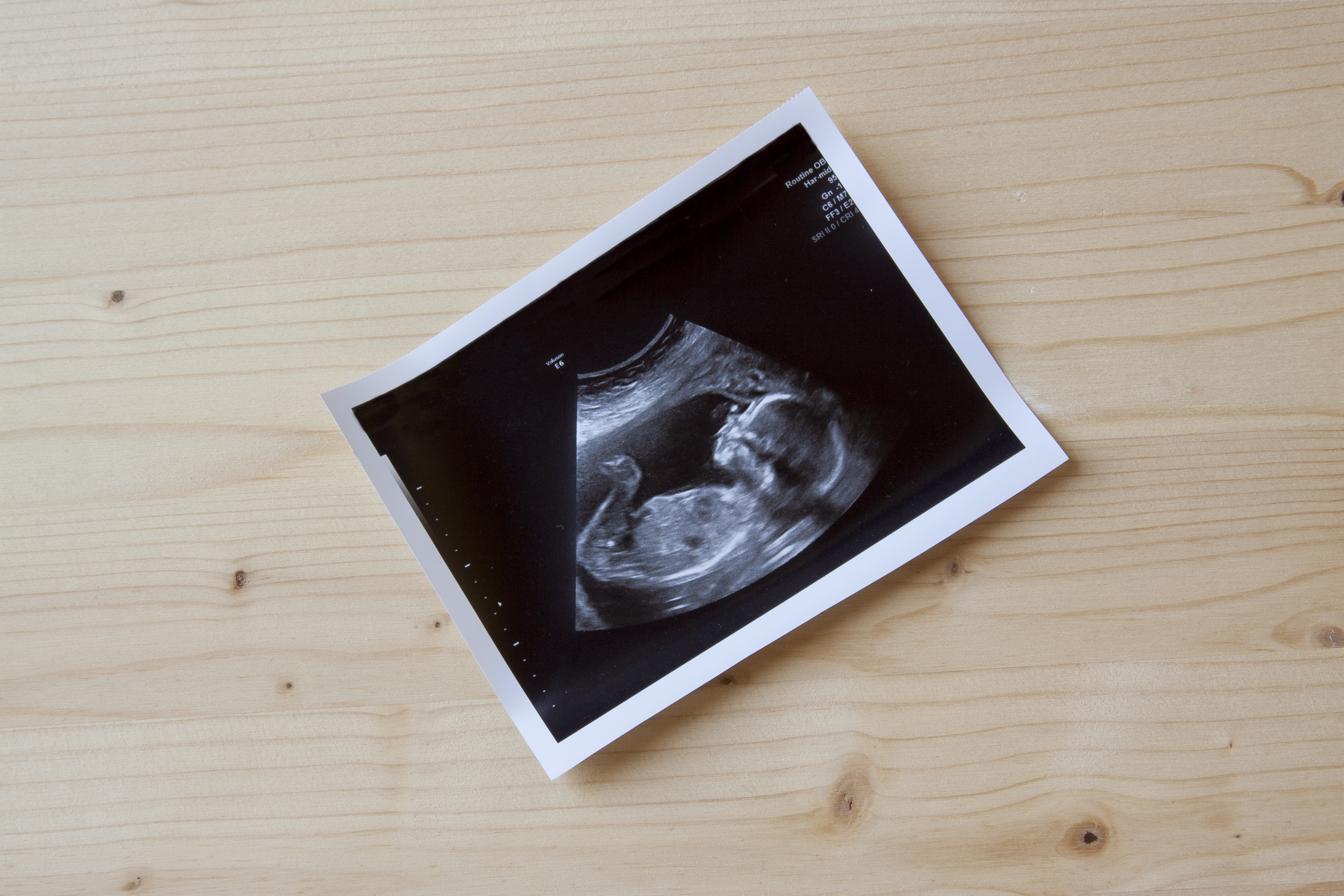 Ultrasound image