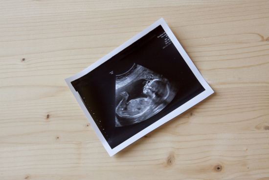 Ultrasound image