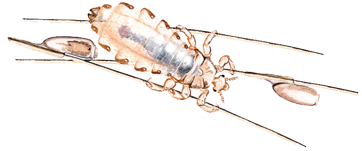 Illustration of a head lice